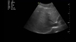 Основы ультразвуковой диагностики