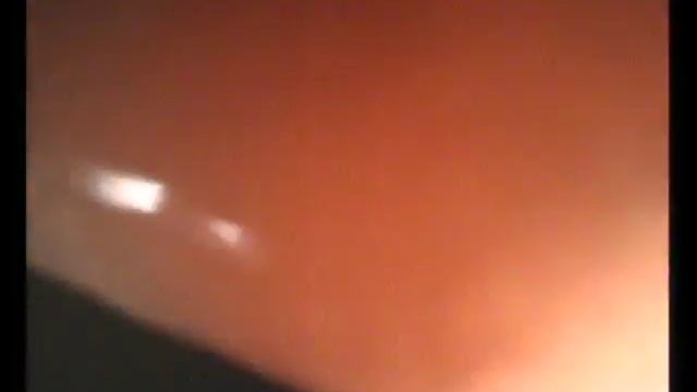 Диагностика гастрита в мариуполе Гастроскопия в Мариуполе Папулы желудка смотреть онлайн