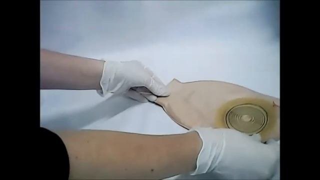 Обзор калоприемников и уроприемников