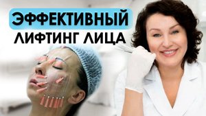 НИТЕВОЙ ЛИФТИНГ ЛИЦА | Какие выбрать и как применять