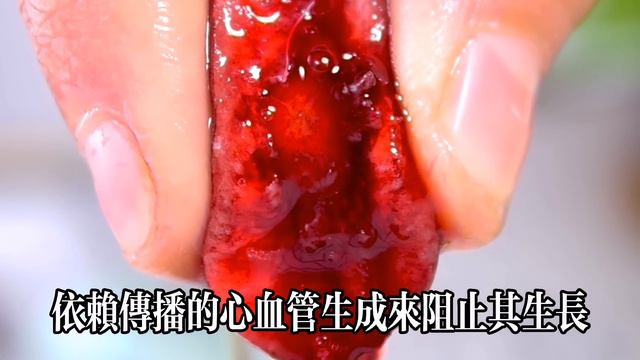 美國癌症研究所終於公布10大抗癌食物咖啡竟也入圍第9名第1名你一定猜不到快看看有沒有你最愛吃的