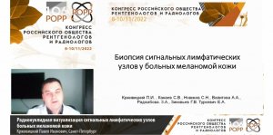 Радионуклидная визуализация сигнальных лимфатических узлов больных меланомой кожи. Крживицкий П.И.