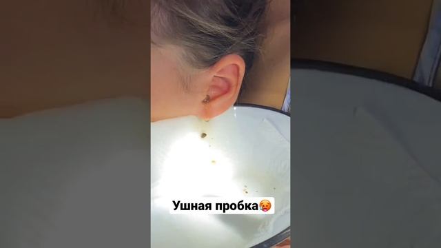 Ушная пробка