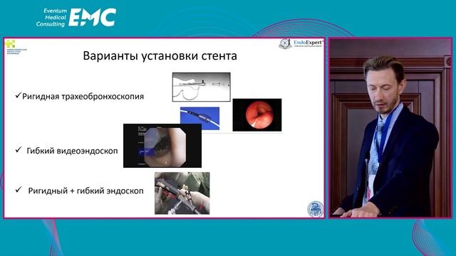 Стентирование трахеи - о чем не принято говорить. Е.А. Дробязгин смотреть онлайн