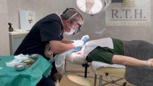 Можно ли пересаживать волосы с тела на голову?