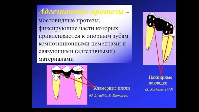 12.09.2022 - Клинические и лабораторные этапы изготовленияискусственных коронок. смотреть онлайн