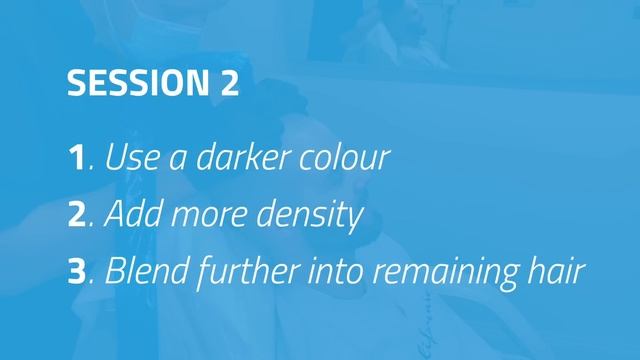 Skalp® Scalp Micropigmentation Treatment Process смотреть онлайн