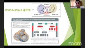 Пациент после лечения наджелудочковой тахикардии