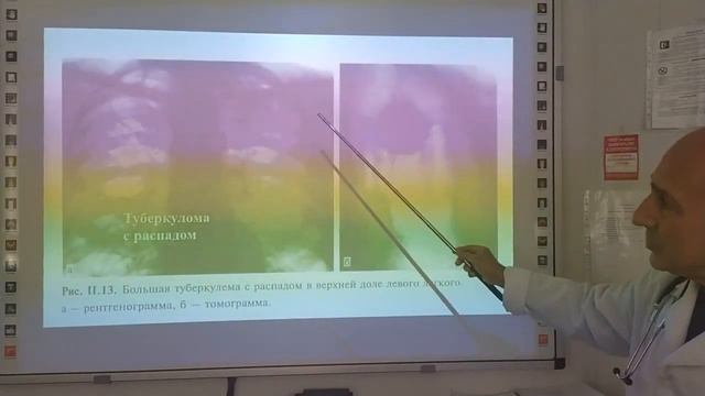 Третья лекция по радиологии