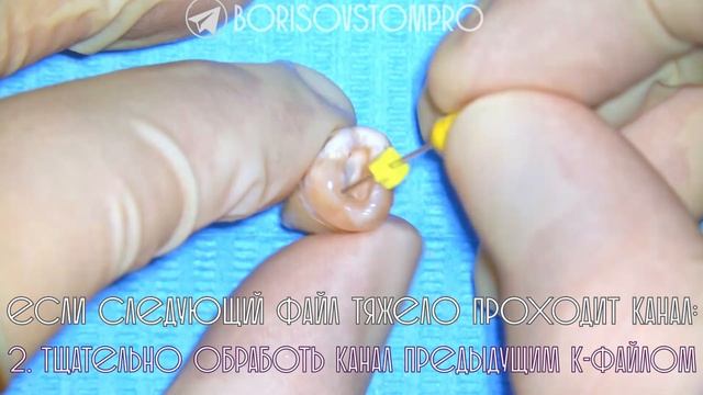 Способы Создания ковровой дорожки