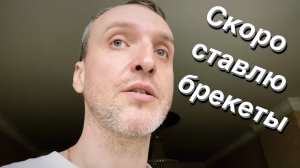 VLOG Сделали план лечения / Ставлю брекеты