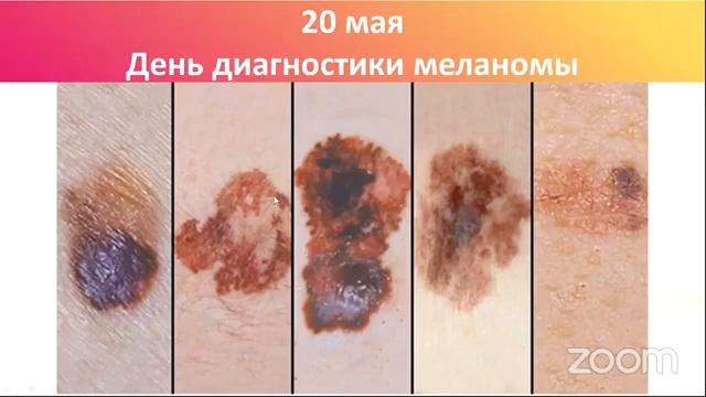 Летний уход за кожей смотреть онлайн