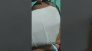 Это просто не реально огромный прыщ на носу!