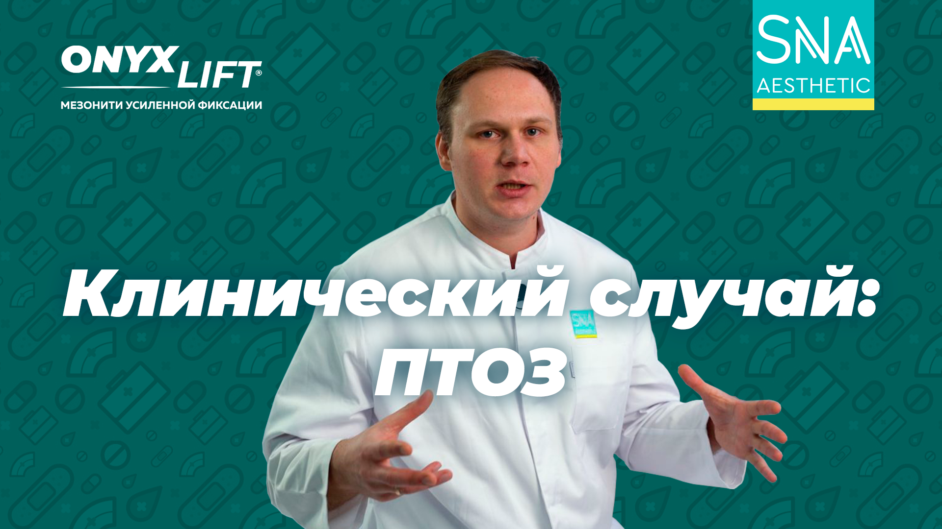 Нитевой лифтинг ONYX LIFT. Клинический случай: ПТОЗ. Коррекция средней и нижней трети.