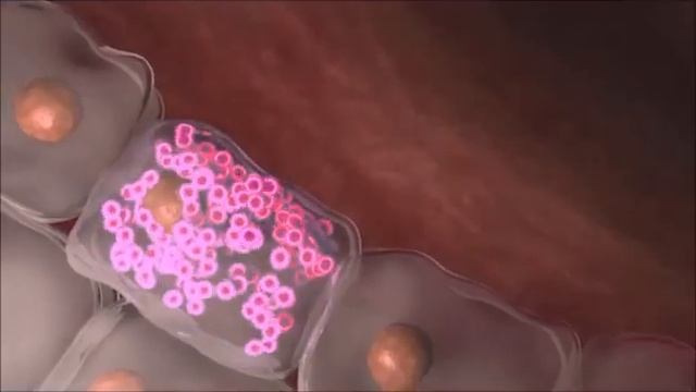 ГРИПП: пути передачи смотреть онлайн