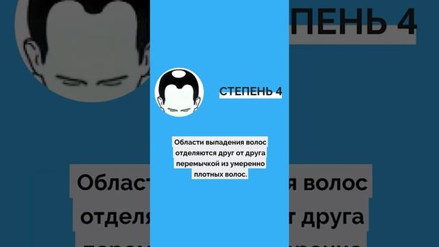 Стадии выпадения волос у мужчин #Shorts