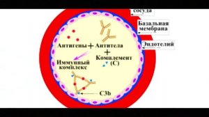 Причины васкулитов