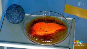 Микробы-диверсанты. Гепатит С. Жить здорово! Фрагмент выпуска от 06.07.2017