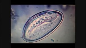 Зрелые яйца остриц с подвижными личинками