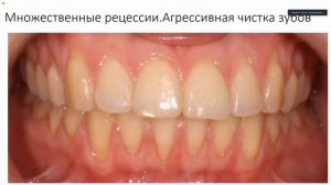 Вебинар 2. "Пародонтология. Простые ответы на сложные вопросы"