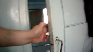 Рожистое воспаление День 17