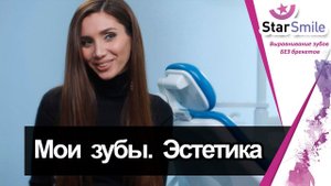 Видео отзыв пациентки Юлии об лечении эстетики улыбки на элайнерах Star Smile