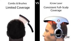 Как работает шлем от облысения iGrow