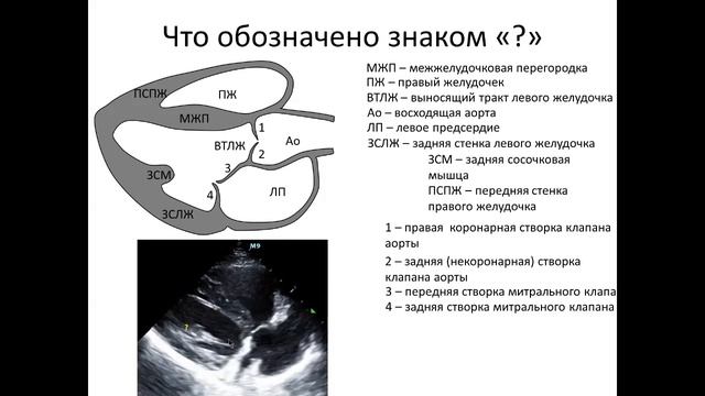 Ультразвуковая анатомия сердца