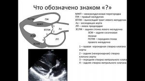 Ультразвуковая анатомия сердца