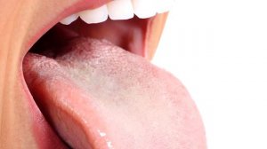 О чем говорит наш язык. Состояние организма по языку