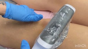 Ipl лазер удаление волос, удаление бактерий акне, удаление пигментации, омоложение