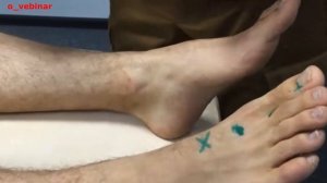 ЛОКАЛИЗАЦИЯ ТОЧЕК КАНАЛА ПЕЧЕНИ. ДЕМОНСТРАЦИЯ НА МОДЕЛИ. ФРАГМЕНТ ВЕБИНАРА. КИТАЙСКАЯ МЕДИЦИНА.