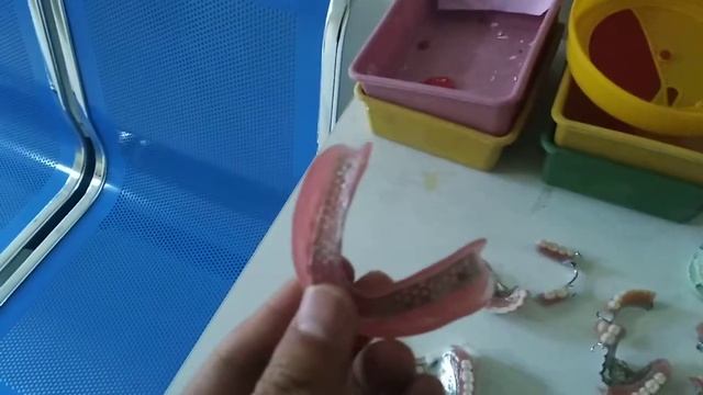 Виды протезов в Стоматологии №1 Хэйхэ Китай смотреть онлайн