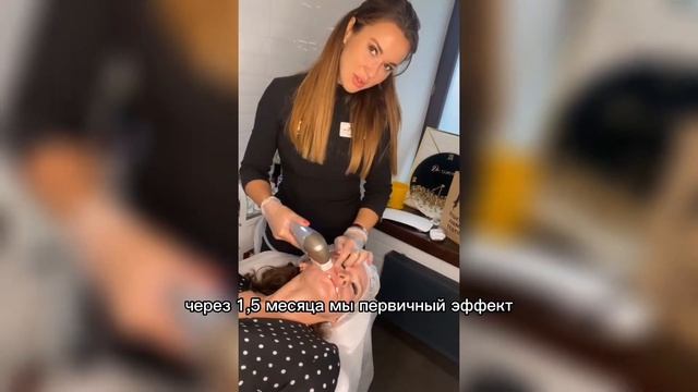 Smas лифтинг. Аппарат Ультраформер. до и после.