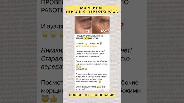 УБРАЛИ МОРЩИНЫ ПОСЛЕ ПЕРВОГО ПРИМЕНЕНИЯ смотреть онлайн