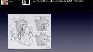 ВПС-4