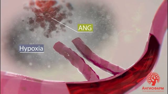 Ангиофарм. Механизм действия ангиогенина. Ангиогенез смотреть онлайн