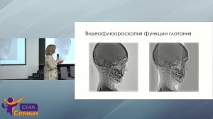 Нарушения функции глотания. От альтернативных способов кормления к естественным