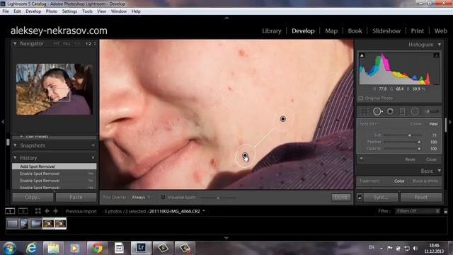 урок 2. Быстрое удаление дефектов кожи в lightroom смотреть онлайн