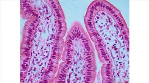 Эпителиальные ткани - 4: Эпителий тонкой кишки
