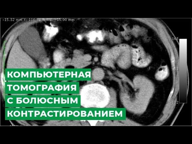 Компьютерная томография с болюсным контрастированием