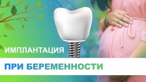 ? Имплантация зубов при беременности - возможно ли?