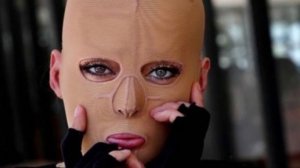 "Жизнь без лица" Девушка сняла маску, которую носила 2,5 года