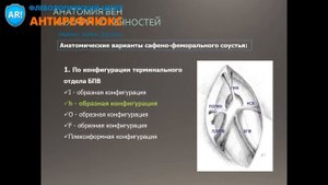 УЗИ вен нижних конечностей - конфигурация СФС