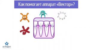 Лечение дёсен аппаратом Вектор в стоматологии "Астродент" (HD)
