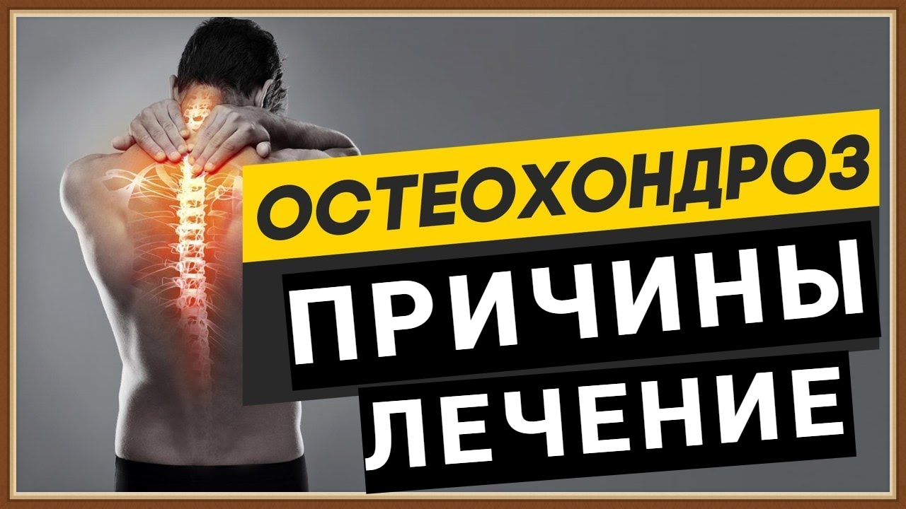 ОСТЕОХОНДРОЗ - ПРИЧИНЫ ЛЕЧЕНИЕ