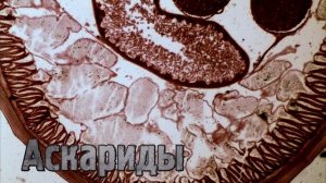 Самые страшные паразиты человека!  часть 2