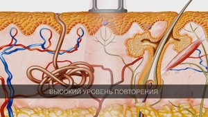 Лазер высокой интенсивности BTL-6000 HIL. Особенности технологии и медицинские эффекты.