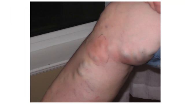 Венская рапсодия смотреть онлайн