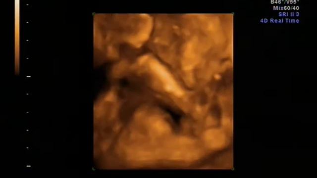 нашей малышке 22 недели смотреть онлайн